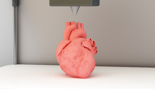 醫學3d打印重建女子頭骨